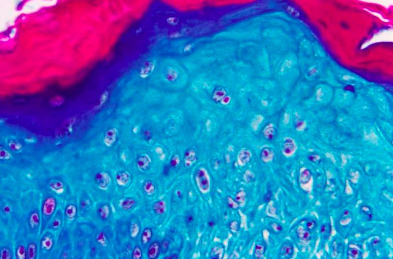 La vacuna contra viruela del mono tarda semanas en inmunizar, indica la OMS