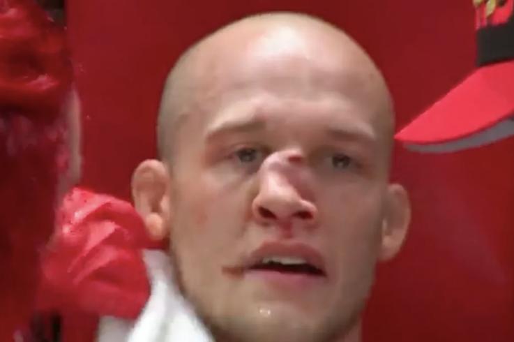 Blake Perry, luchador de MMA.