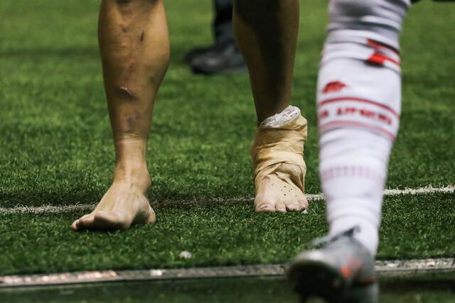 Matías Cahais se perderá la recta final del torneo tras su rotura del tendón de Aquiles.