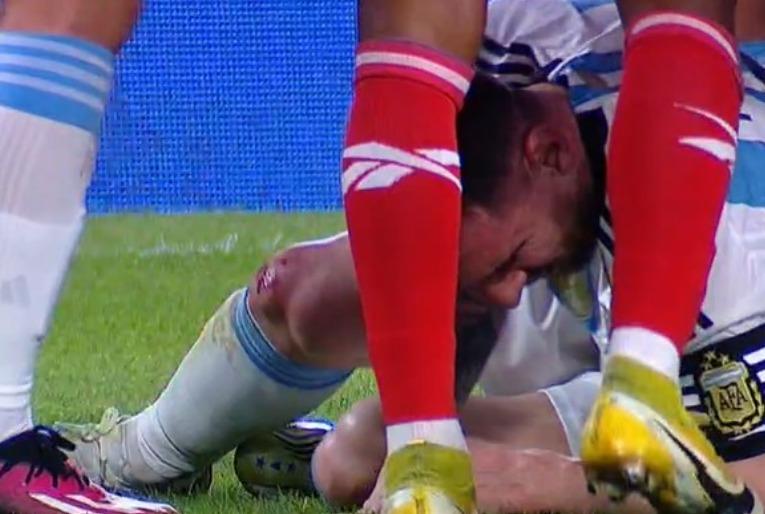 Lionel Messi recibió feroz patada en el duelo amistoso ante Panamá / Foto: Captura