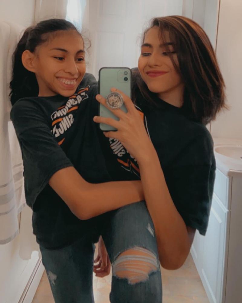 Siamesas Lupita y Carmen