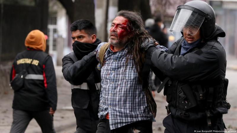 DW - Un manifestante herido es detenido por policías en la ciudad argentina de Jujuy, el 20 de junio de 2023.