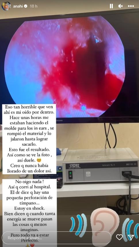 "No oigo nada": Anahí sufre la perforación de su tímpano a tres meses del comienzo de la gira de RBD