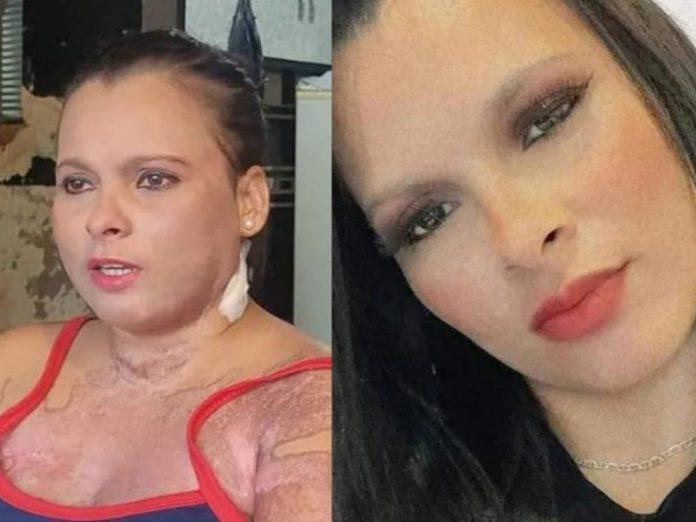 Mujer despertó del coma y denuncia intento de femicidio - EPTV