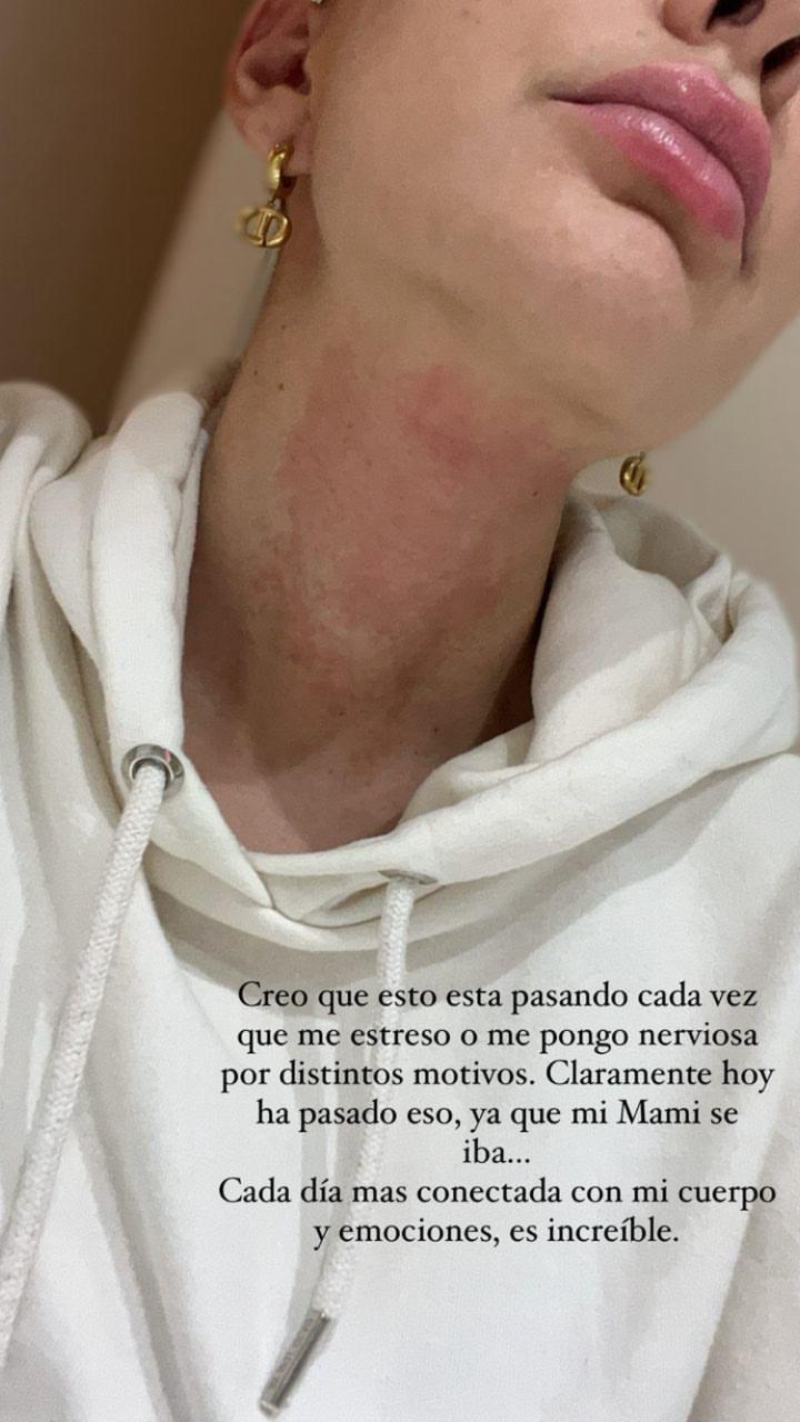 Instagram Aylén Milla