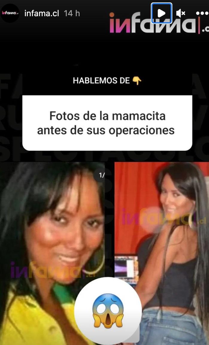 Sonia Isaza antes de operarse (Imágenes Infama)