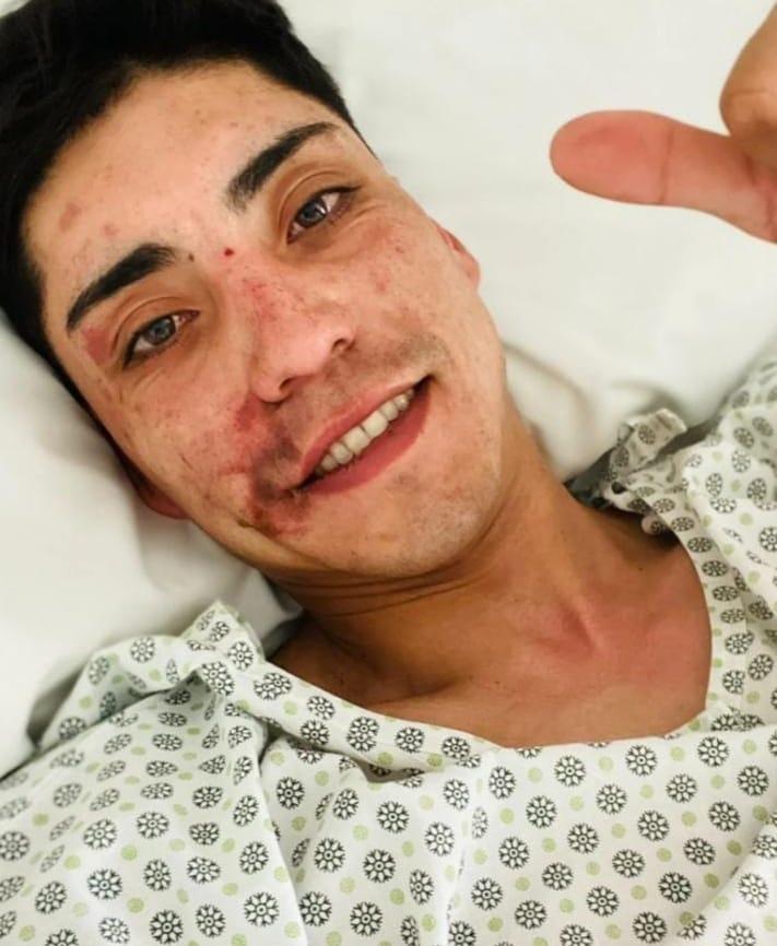 Así terminó Jans Vega tras el accidente con Rodrigo Lizama (Facebook)