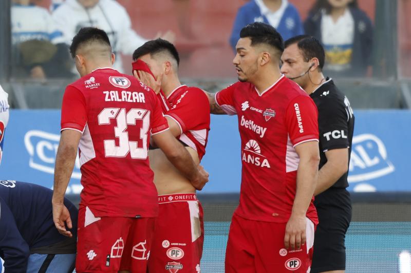 Raimundo Rebolledo salió afligido del duelo entre la UC y Ñublense tras la lesión de Eugenio Mena - Créditos: Photosport