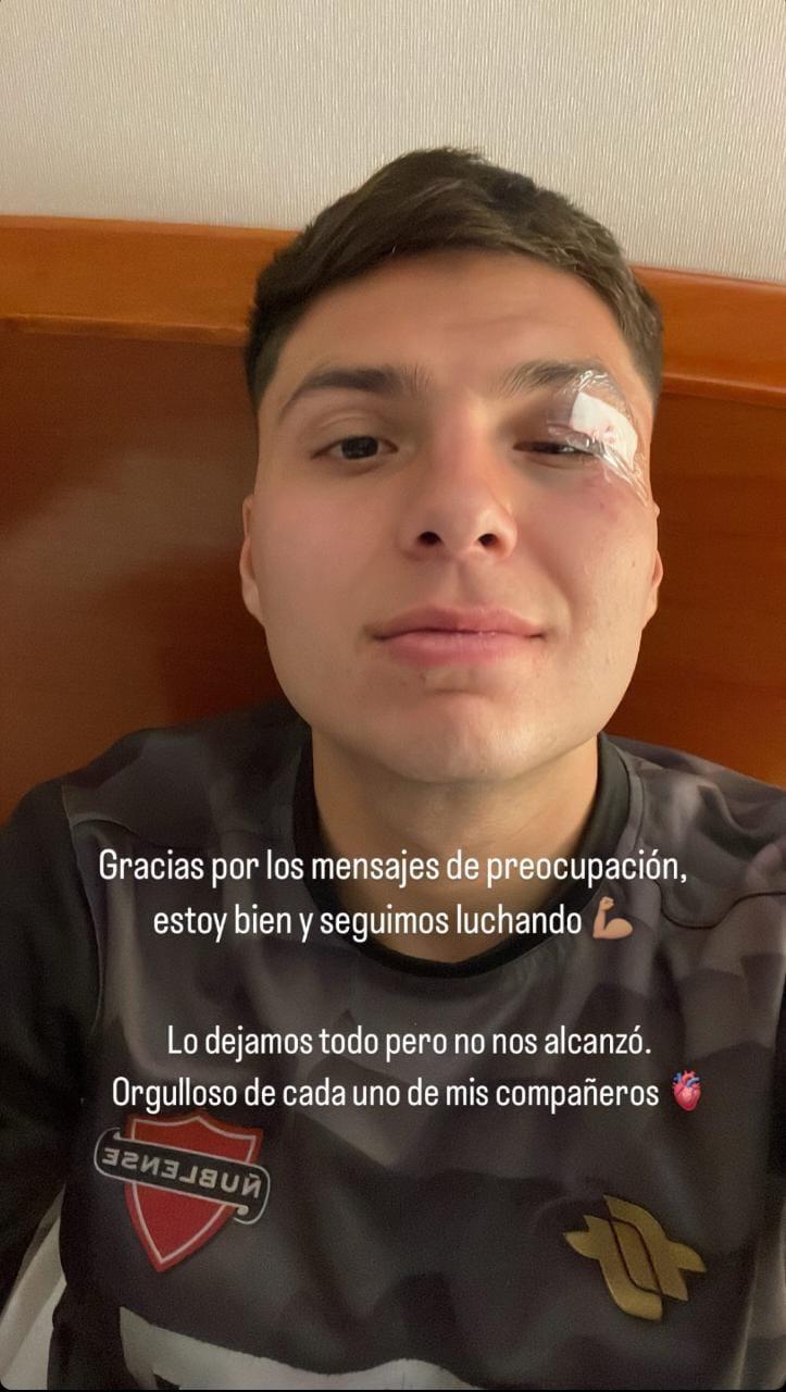 Raimundo Rebolledo recibió un brutal golpe en duelo de Ñublense y LDU de Quito. / Foto: Instagram