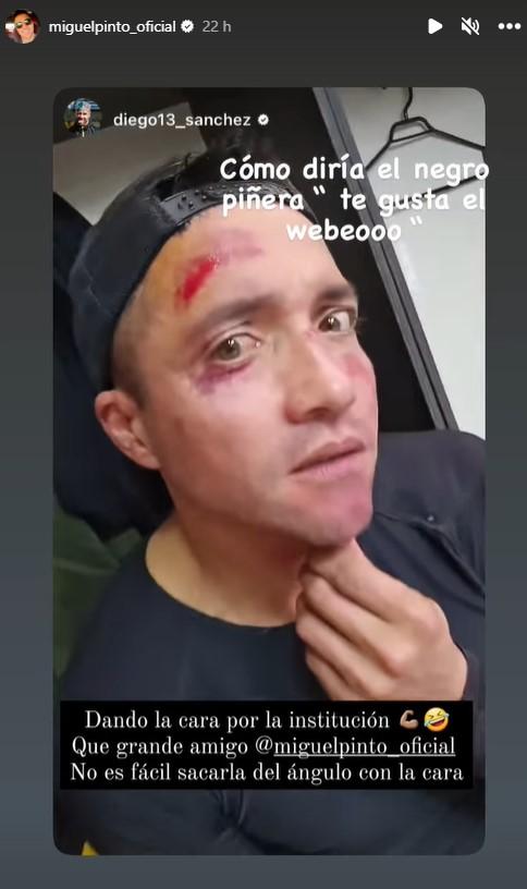 Miguel Pinto - Créditos: Captura Instagram