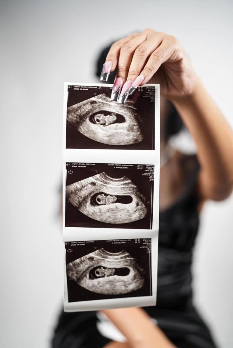 Facebook - Mujer anunció embarazo con sesión fotográfica de un funeral