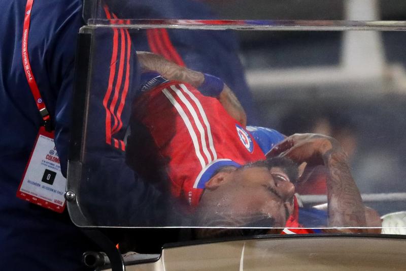 Arturo Vidal fue operado de urgencia tras el partido con Colombia. (Agencia Uno)