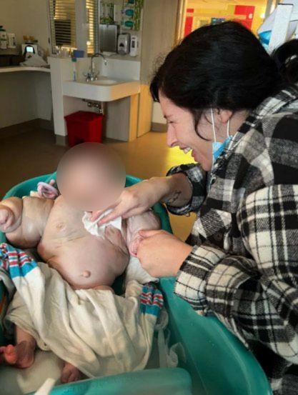 X - Bebé nace con extraña condición que provoca hinchazón de brazos y pecho