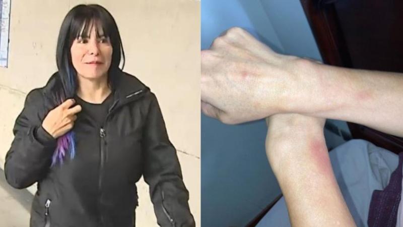 Anita Alvarado quedó con moretones tras detención en el aeropuerto