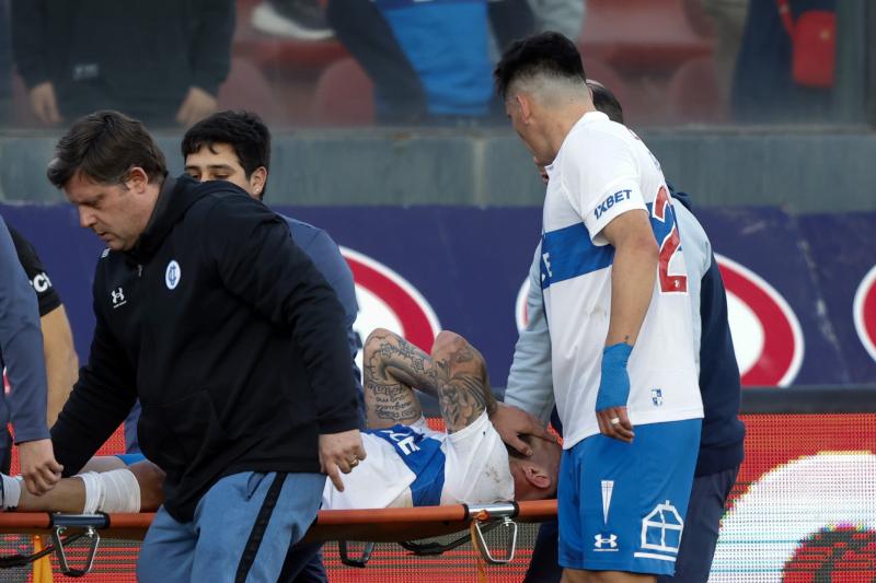 Eugenio Mena trabaja en la recuperación de una doble fractura - Crédito: Photosport