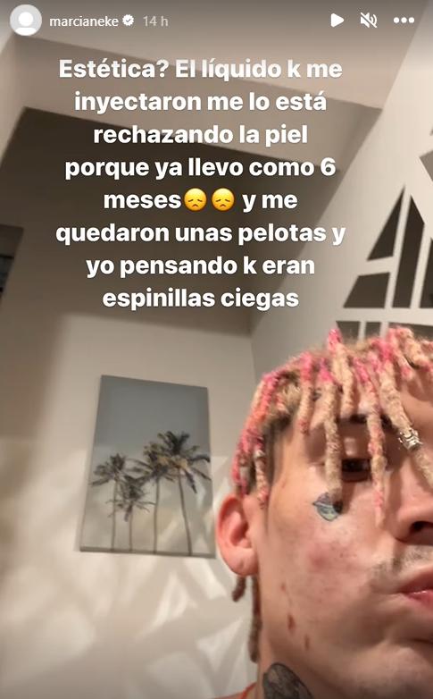 Instagram @marcianeke - Captura de sus stories en IG.