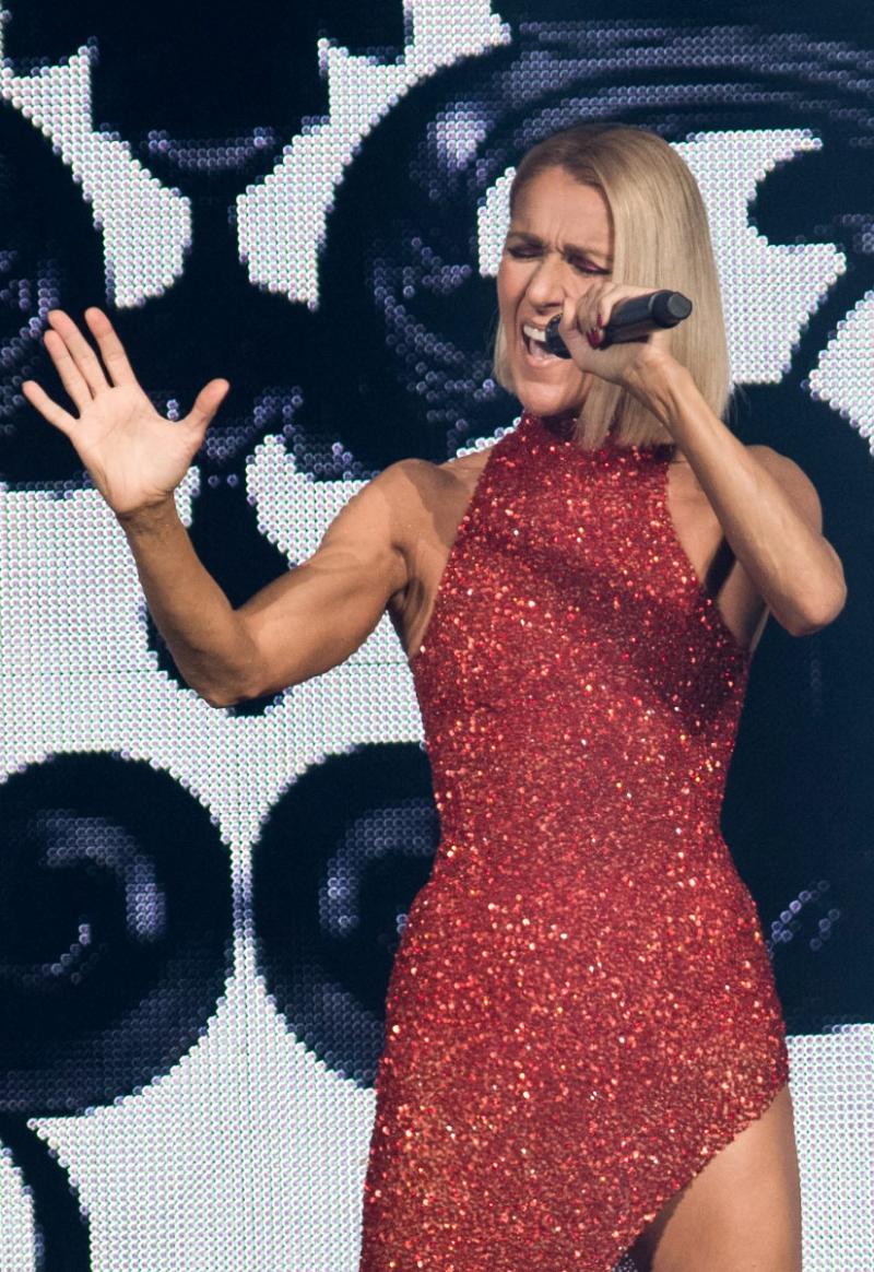 AFP | Síndrome de la persona rígida: ¿Cuáles son las causas de la enfermedad que afecta a Celine Dion?