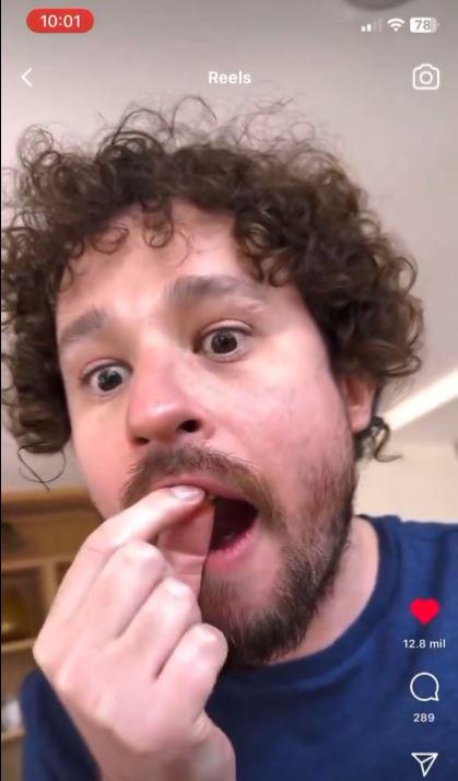 Captura - Luisito Comunica perdió dientes en vivo