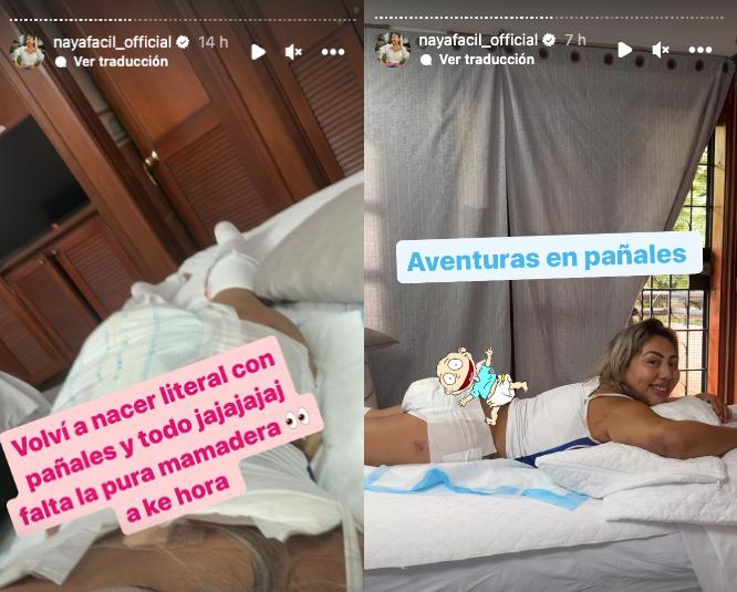 Naya Fácil y su reflexión tras operarse en Colombia