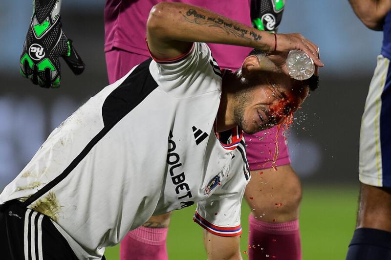 Ramiro González tuvo jornada para el olvido en Colo Colo - Crédito: Photosport.
