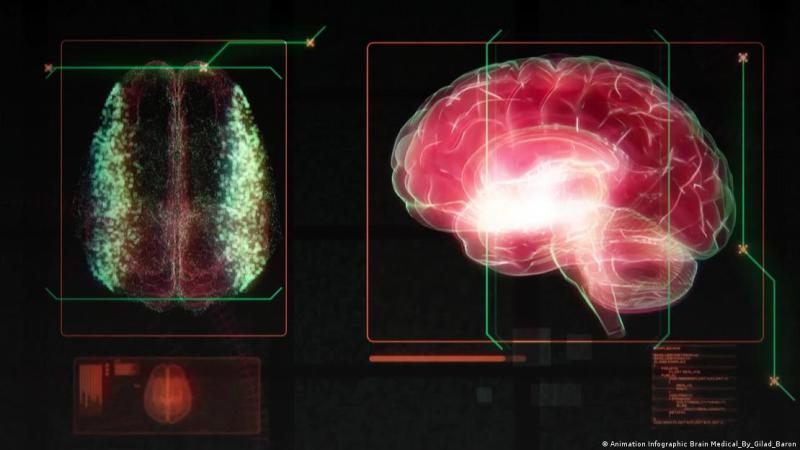 Representación del cerebro - Deutsche Welle