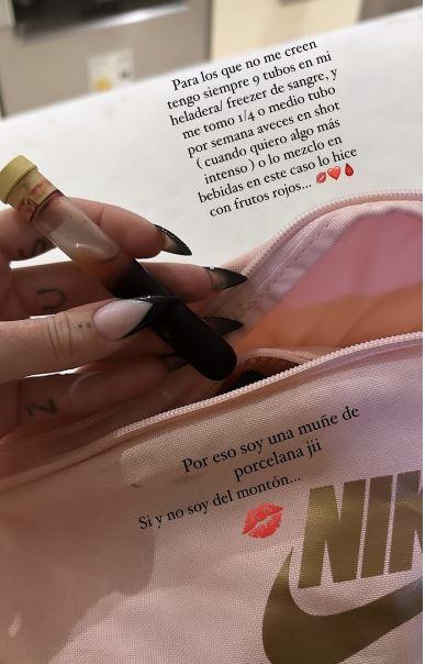 Modelo argentina asegura que bebe su propia sangre para mantenerse joven