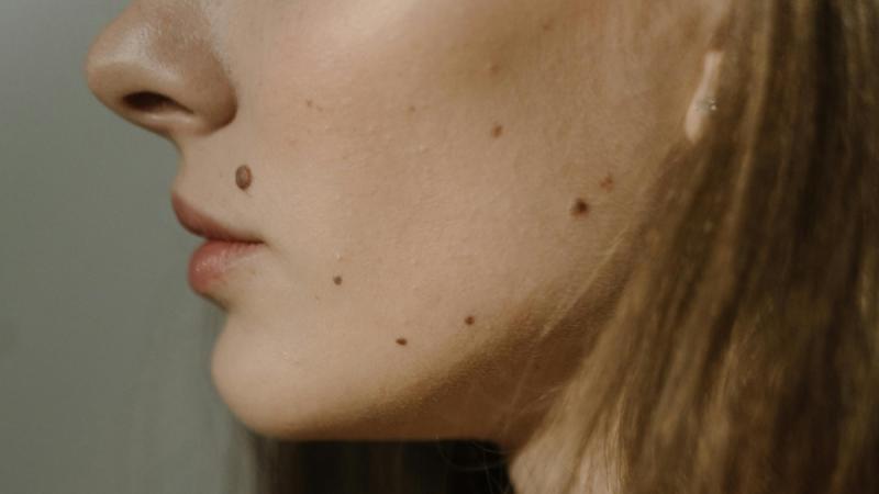 Referencial - pexels.com