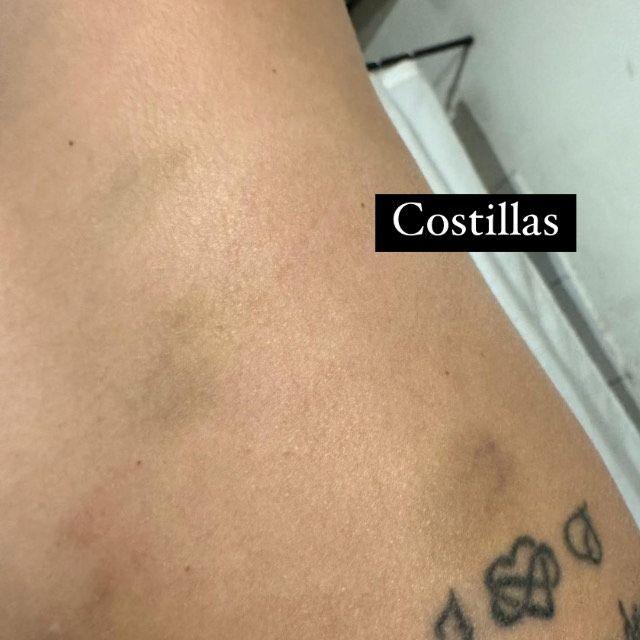 Las imágenes de la herida de Faloon / Instagram