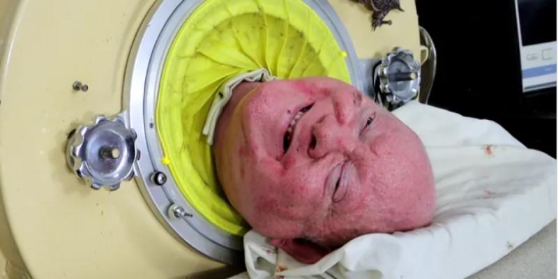 Muere Paul Alexander, hombre que vivía con pulmón de acero