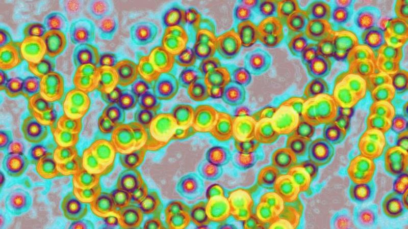 The Guardian - Bacteria estreptococo de grupo A