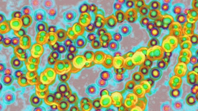 The Guardian - Bacteria estreptococo de grupo A