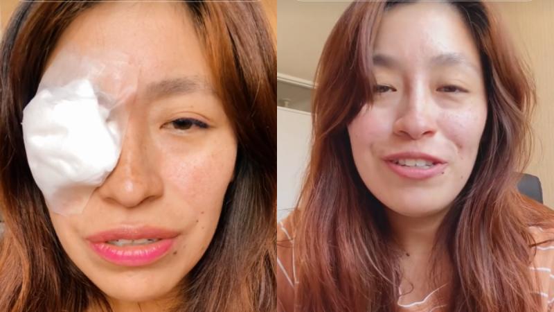 Joven denunció heridas en su ojo en concierto de Karol G - TikTok