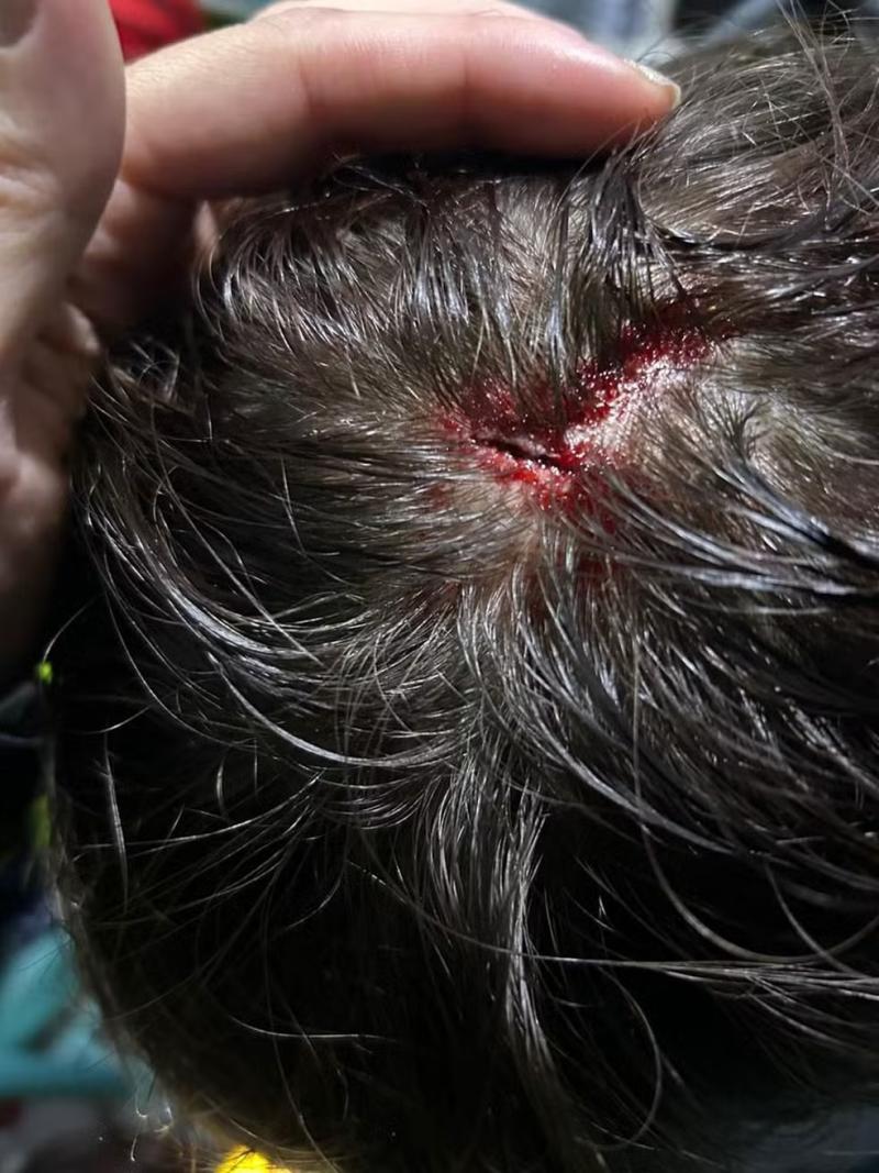 Hincha de Fluminense acusa agresión tras el partido contra Colo Colo. / Foto: ge.globo.com