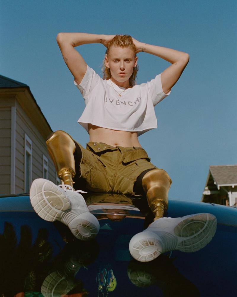 @theimpossiblemuse / Mujer pierde ambas piernas por "shock tóxico" de un tampón