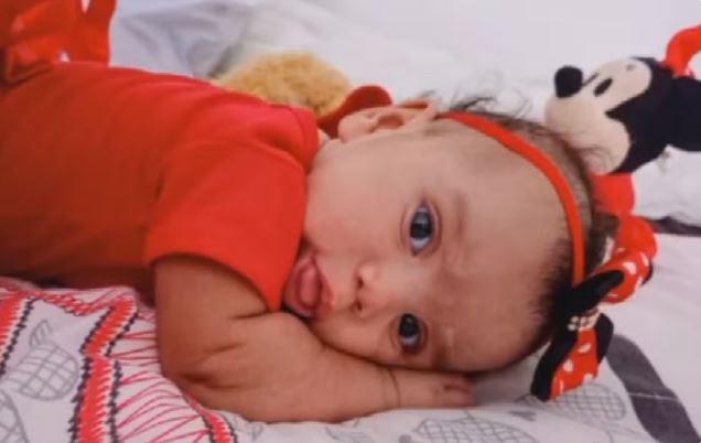 Muere niña atacada por perro - Reproduccion/TV Anhanguera