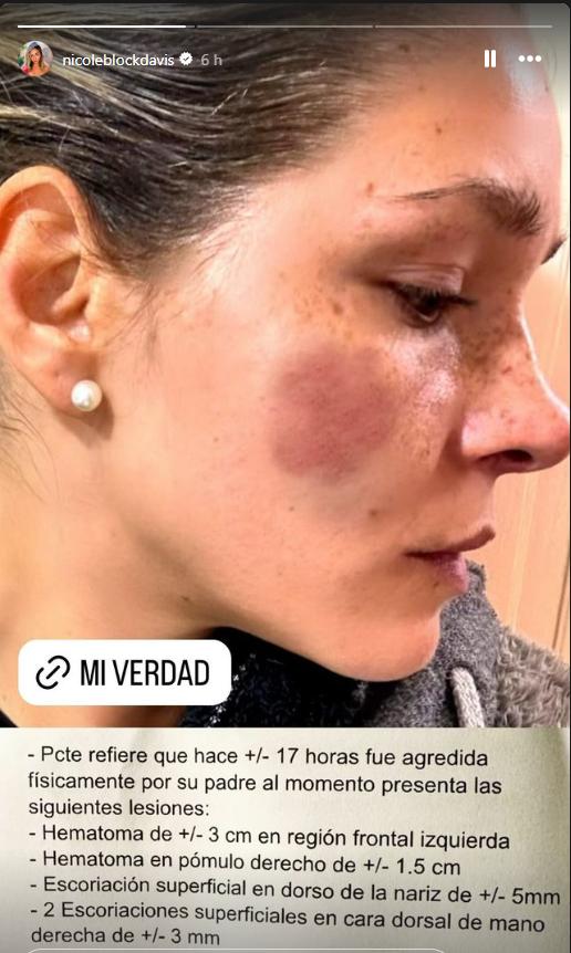 Nicole Block compartió relato acusando haber sido víctima de abusos y violencia por parte de su padre - Instragam