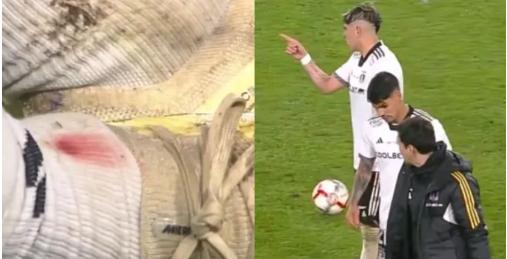 Carlos Palacios quedó sangrando en duelo de Colo Colo - Créditos: TNT Sports