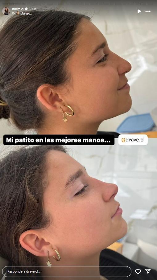 Antes y después hija de Gissella Gallardo - Instagram