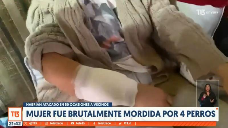 Mujer fue brutalmente mordida por cuatro perros en Llolleo - T13