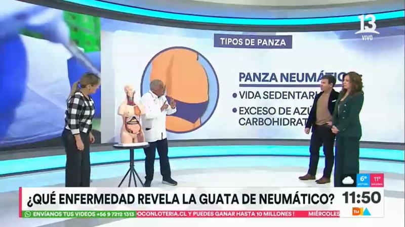 Canal 13 - Tipos de abdomen