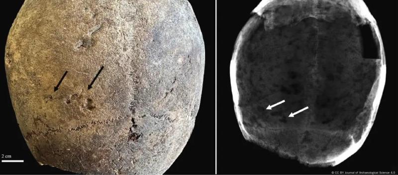 Cocaína en momias europeas - Imagen: CC BY Journal of Archaeological Science 4.0