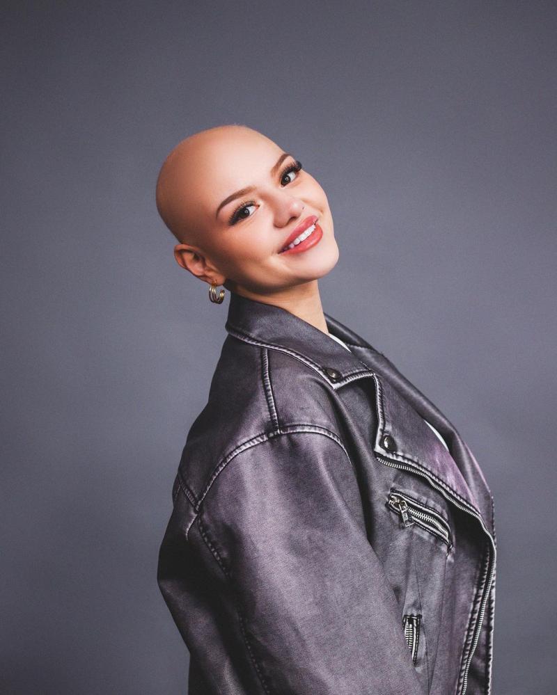 La enfermedad y el mensaje de Isidora Carvallo, candidata a Miss Mundo Chile 2024