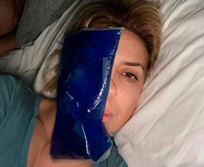 T13 | Revelan imágenes de Fabiola Yañez golpeada y con los ojos morados en medio de causa contra Alberto Fernández