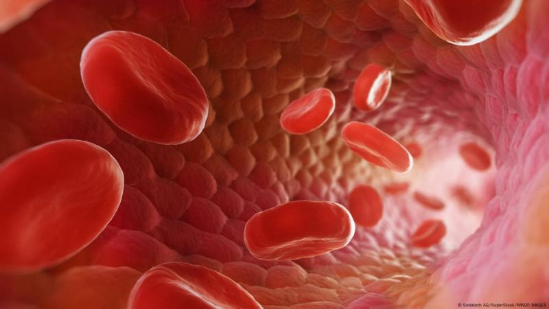 DW - Se trata del raro grupo sanguíneo AnWj.