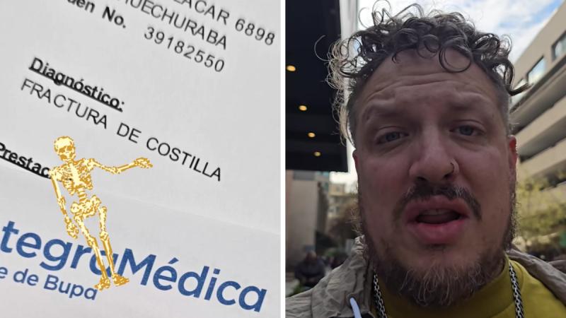 Tomás Leiva de 'Tomás Va a Morir' se fracturó la costilla - Instagram