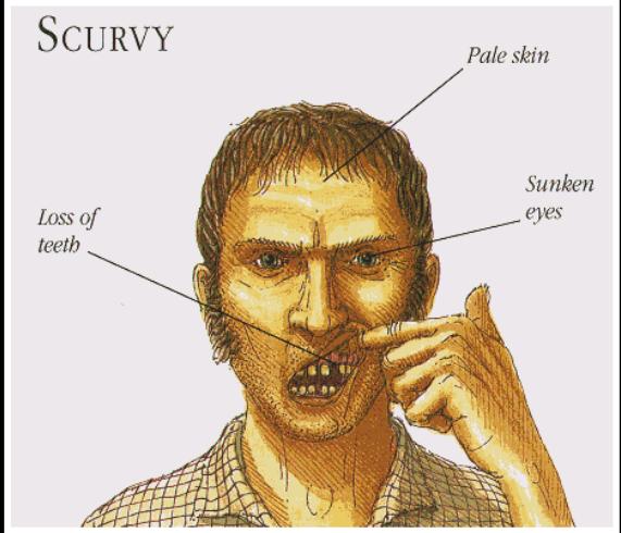 Escorbuto - X @IlindelatorreMD