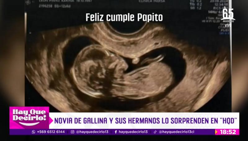 Rodrigo Gallina se convertirá en padre por primera vez - Hay que decirlo
