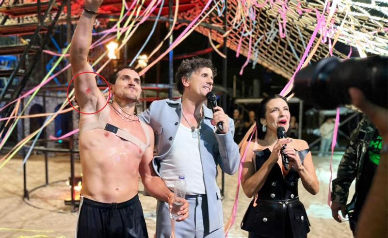 Canal 13 - Pangal Andrade con la lesión en la final de '¿Ganar o Servir?'