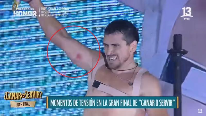 Canal 13 - Pangal Andrade con la lesión en '¿Ganar o Servir?'