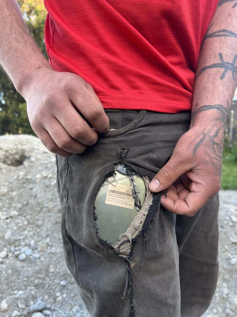 Albañil salvó su pierna del corte de una sierra por celular que tenía en el bolsillo